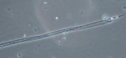 อ่อนแอ nitzschia