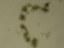 Microcystis aeruginosa