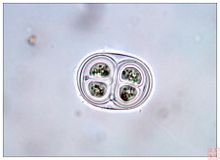 ประเภท Chroococcaceae