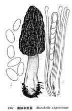 เส้นเลือดดำ Morel